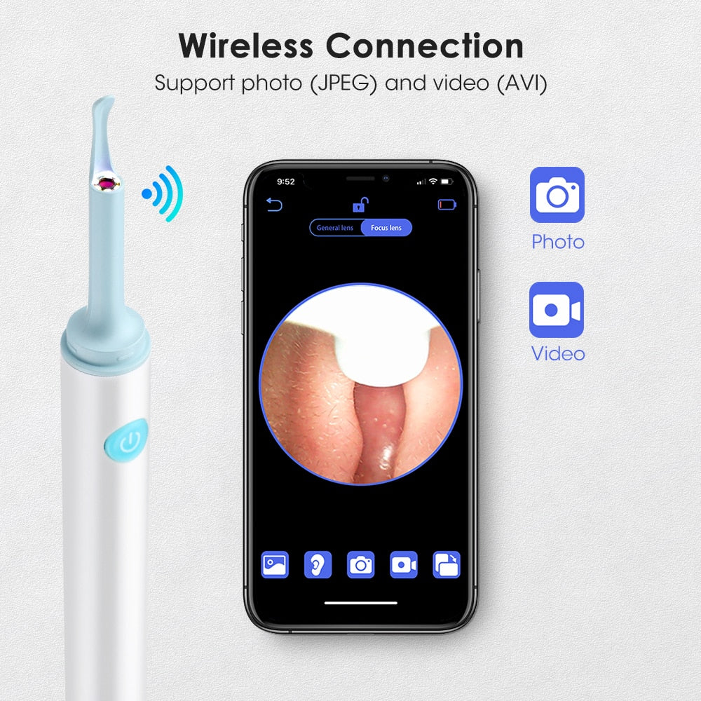Smart Visual Ear Wax Cleaner with camera